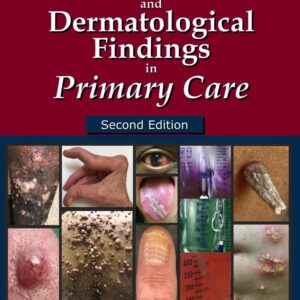 Common Clinical and Dermatological Findings in Primary Care