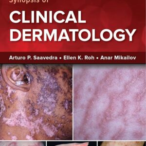 Fitzpatrick's Color Atlas and Synopsis of Clinical Dermatology, Ninth Edition