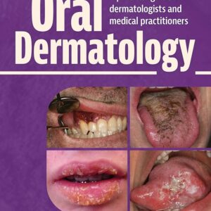 Oral Dermatology