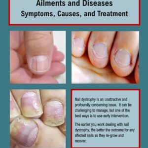 THE HUMAN NAIL - Ailments and Diseases: Symptoms, Causes, and Treatment