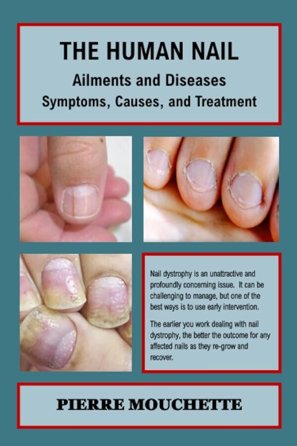 THE HUMAN NAIL - Ailments and Diseases: Symptoms, Causes, and Treatment